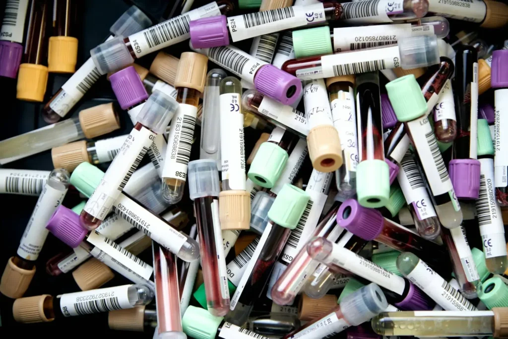 Labordiagnostik – Blutwerte für deine Gesundheit